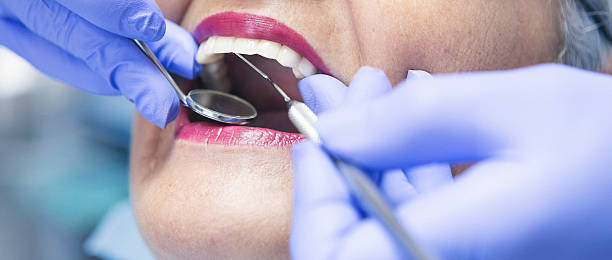 Best Emergency Dental Extractions in Titusville, FL